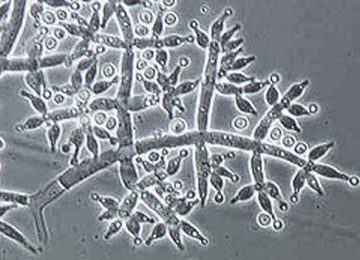 bfb3b4bec1701826368bab7ac212e8ed